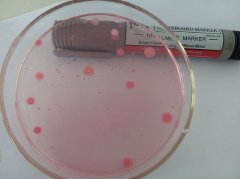 ATP熒光檢測器識別細(xì)菌的優(yōu)缺點(diǎn)